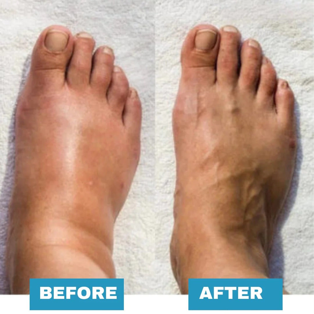 🔥 Foot Massager - For Lasting Foot Pain Relief