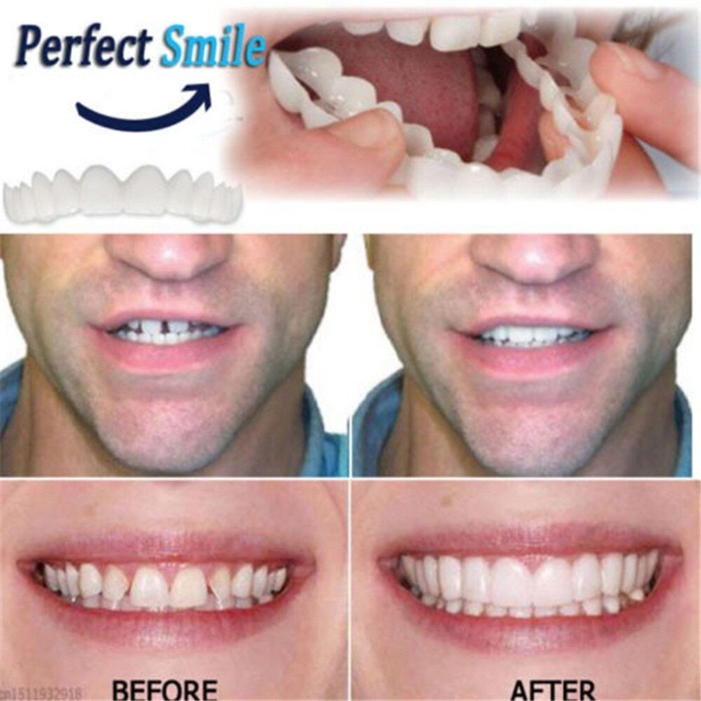 🎉Snap-On Dentures
