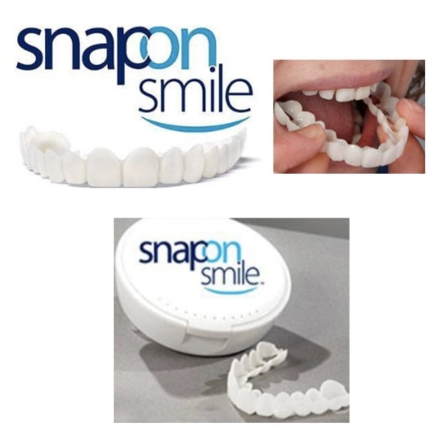 🎉Last Days 58%OFF 🎉Snap-On Dentures