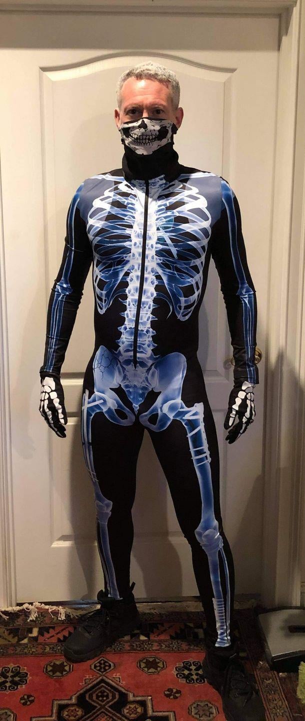 🎃Halloween Sale -SexySkull Bodysuit