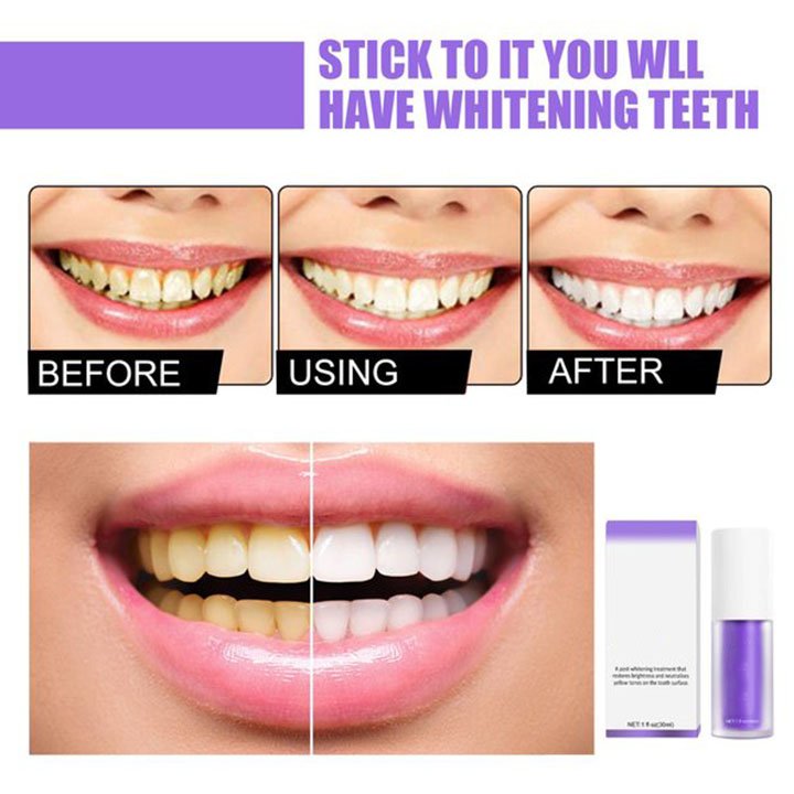 🔥LAST DAY 48% OFF🔥Teeth Colour Corrector Serum